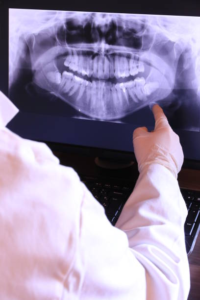 Best Dentist for Tooth Abscess  in Thorndale, PA