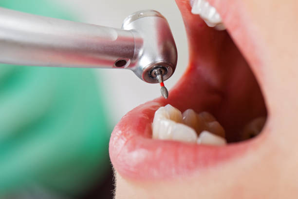 Best Emergency Tooth Extraction  in Thorndale, PA